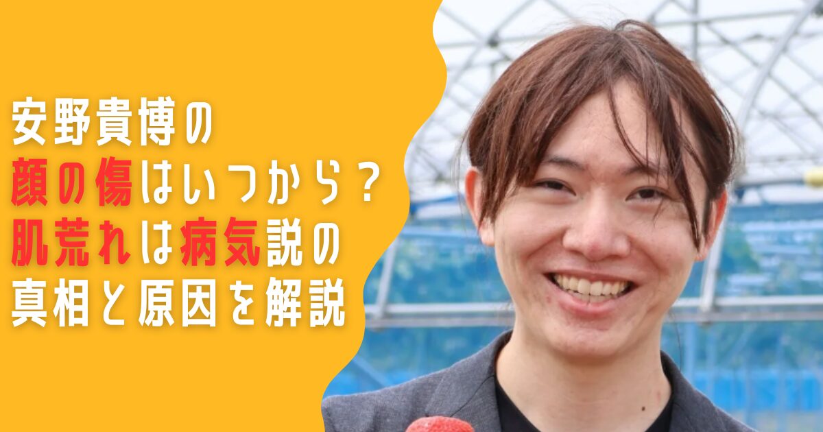 安野貴博　顔の傷　肌荒れ　病気　原因　ニキビ